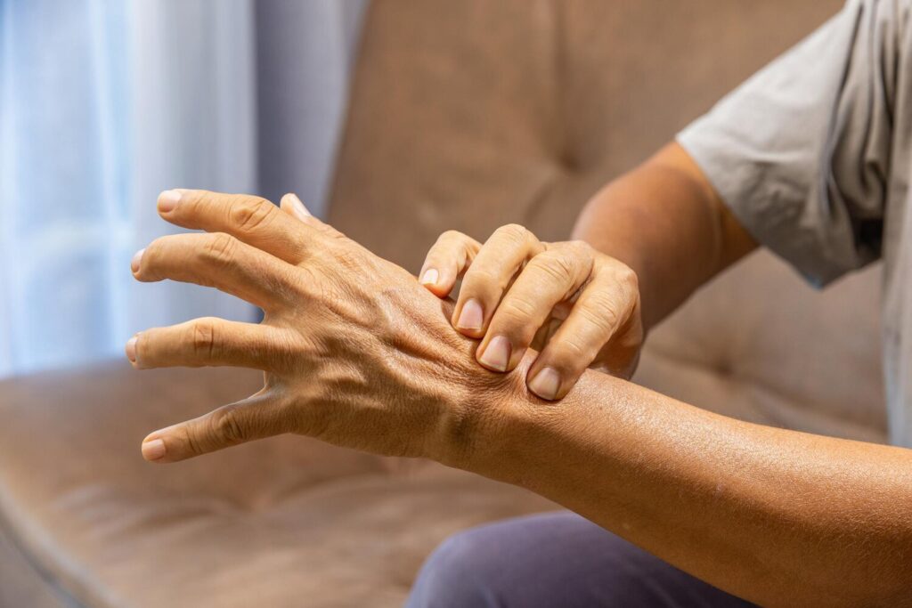 Senior man hand suffering from joint pain with gout inflammation 176124 2378 Senior man hand suffering from joint pain with gout inflammation 176124 2378