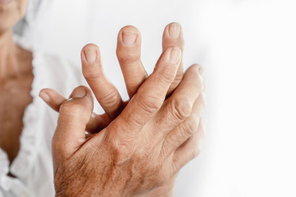 Close up senior woman with wrinkled fractured hands 1048944 12093913 Close up senior woman with wrinkled fractured hands 1048944 12093913